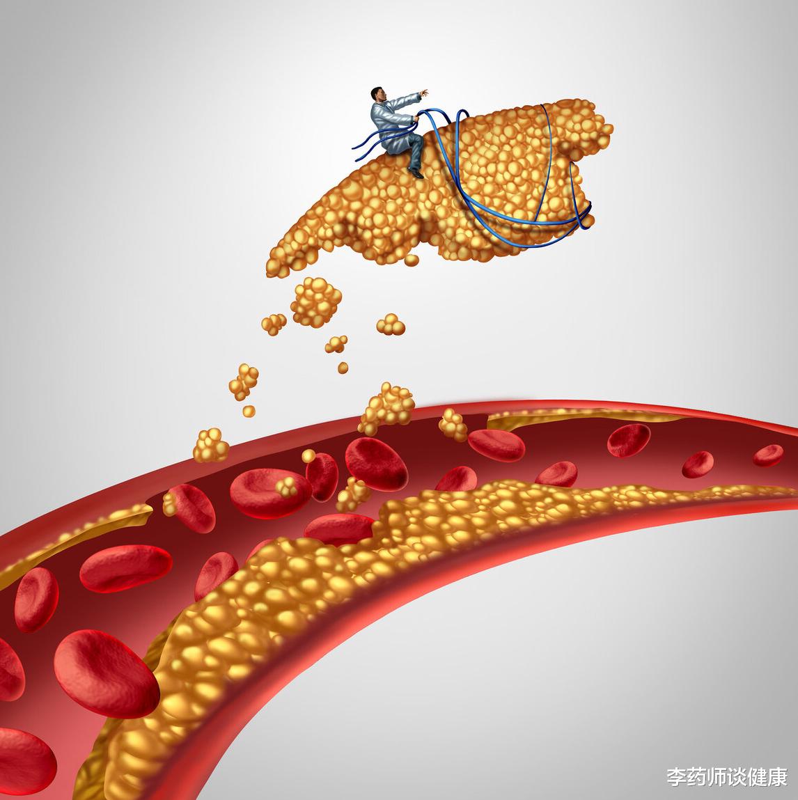 李药师谈健康|进入集采的4种他汀，价格最高下降97%，降脂有何特点？分别说清