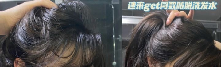 爱吃糖果的辣妈|双11孕期洗发水提前购!控油、去屑、滋润、防脱,效果堪比换头!