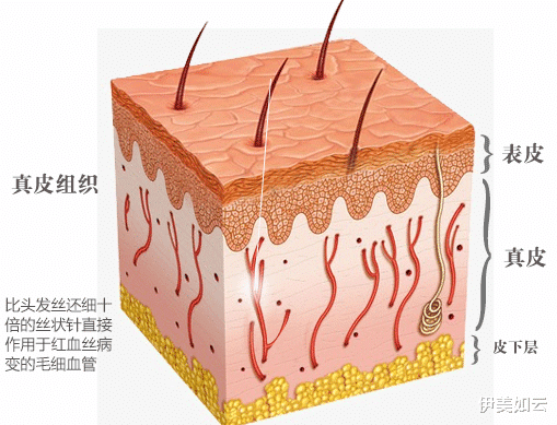 伊美如云|酸类产品用多了,会出现红血丝吗?