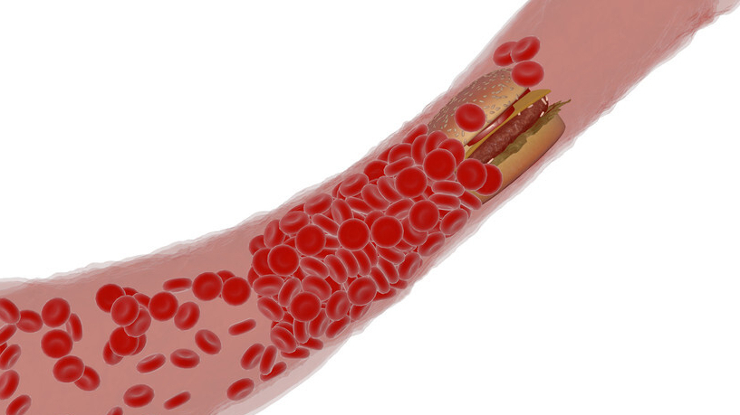 养生早班车|血管变堵,这些常通血管的食物要常吃!心血管疾病患者别错过了