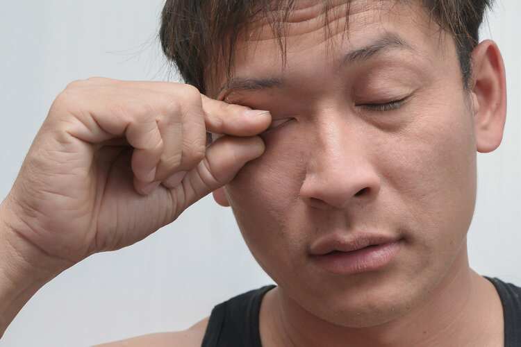 疾病|便宜好用的红霉素软膏功效多,主要治疗什么?这些小毛病或能解决