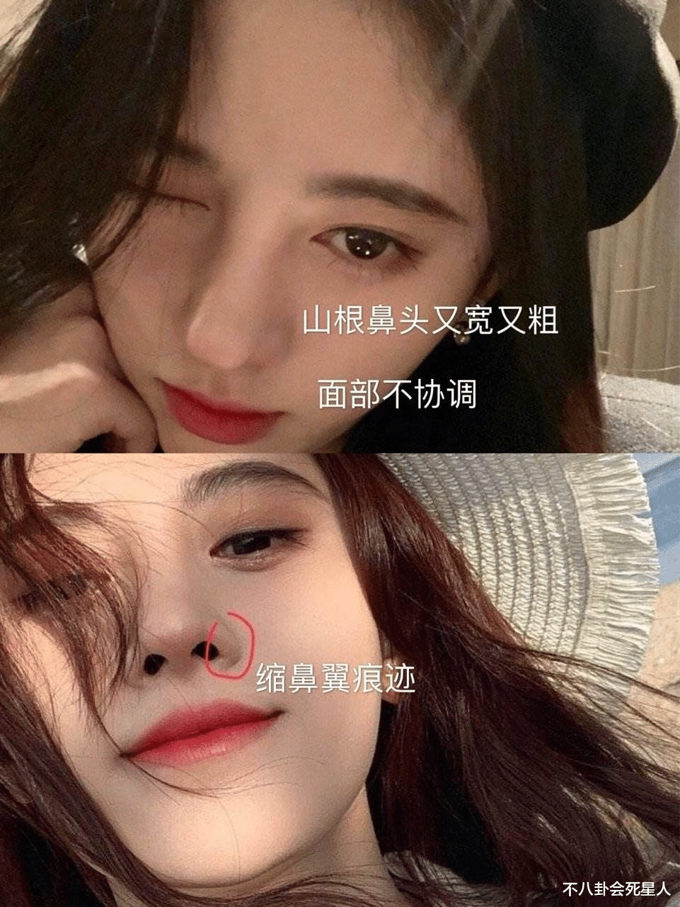 杨幂|那些乱整鼻子的女星还好吗？后遗症一大堆，杨幂金晨都开始崩了