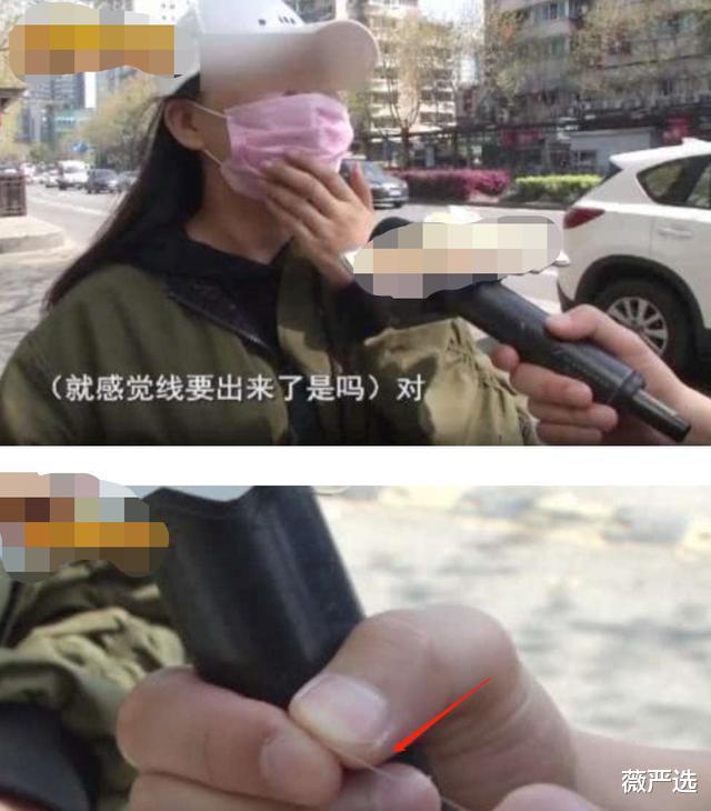 蓝光 女子为变美“不择手段”，脸上埋下百根“金丝”，如今怎样了？