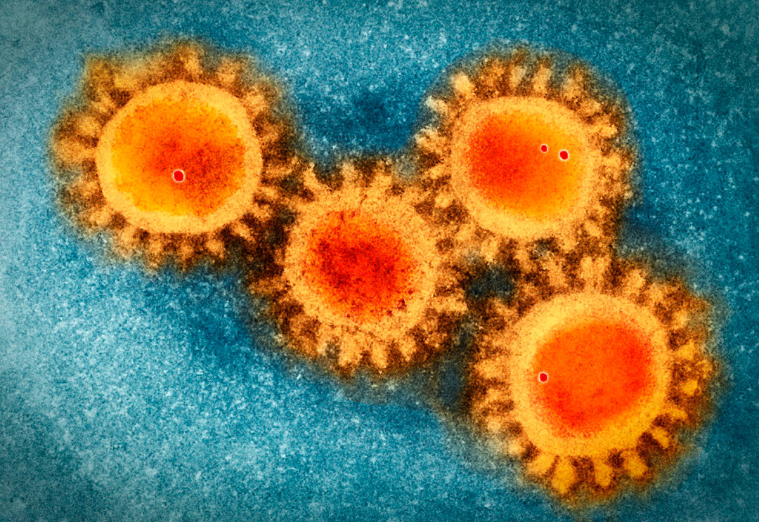 冠状病毒 英国科学家：冠状病毒疫情早在21000年前爆发，东亚人的DNA有印记