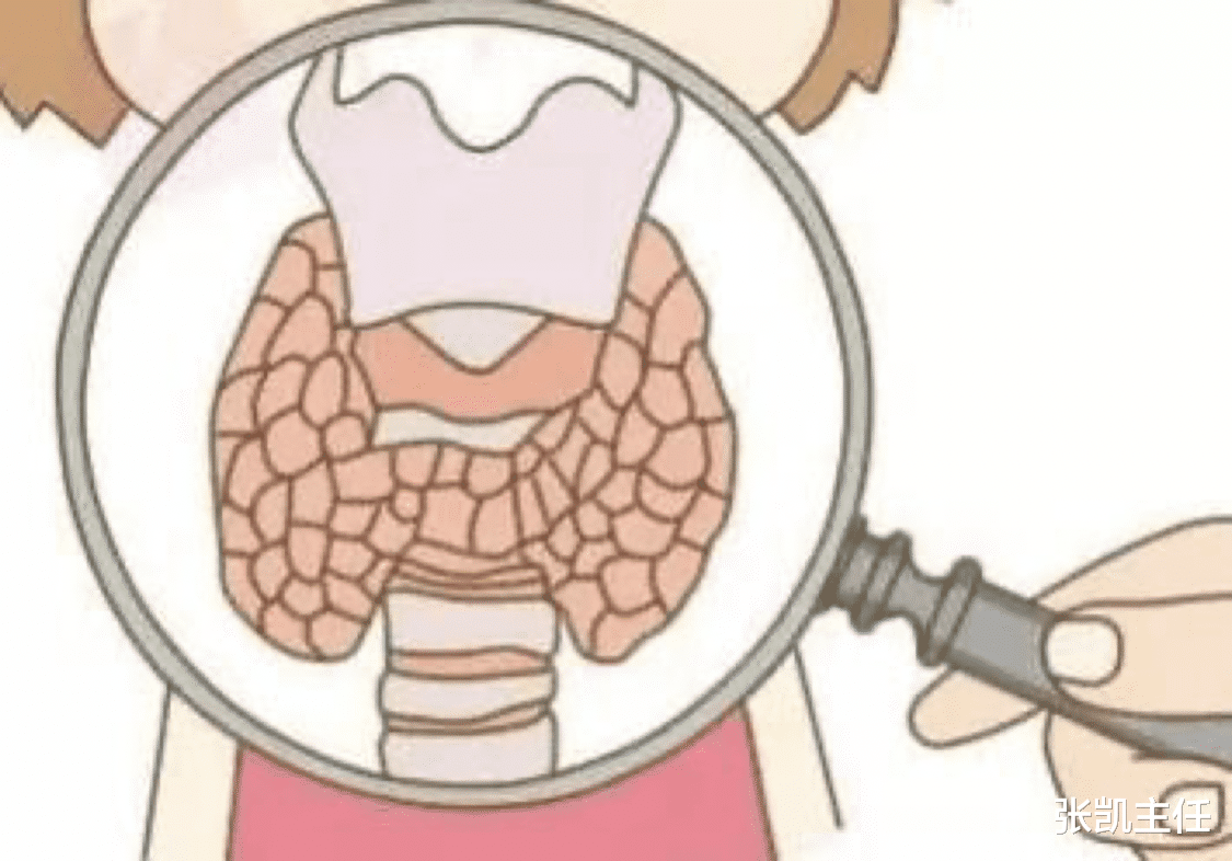 张凯主任|那些总是睡不醒的人，不一定是睡眠不足，也有可能是“甲减”