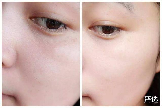 李金斗|赵本山女儿整容后皮肤细腻状态好，网友：终于摆脱“鞋拔子”脸了