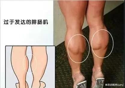 体态训练师curry|小腿粗壮是无数个妹子的噩梦！如何正确的训练改善解决问题？