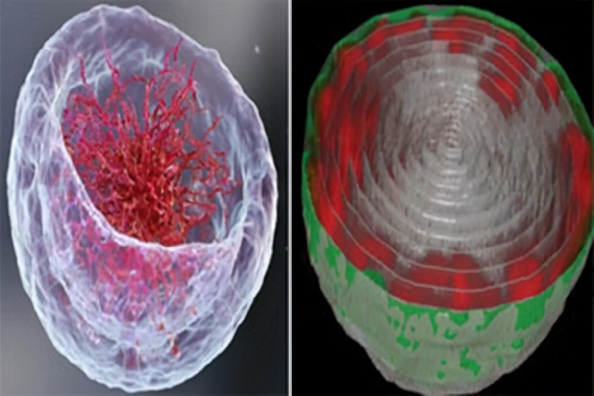 基因 新成像方法揭示细胞核中DNA的排列方式