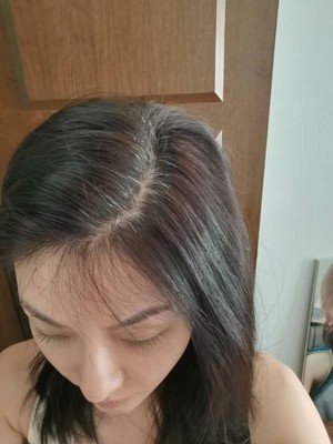 |白头发多吃什么可以调理