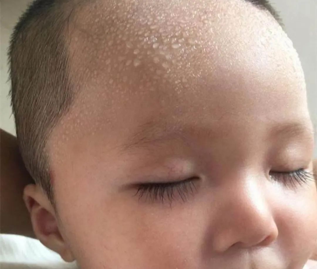 饭饭妈妈育儿|宝宝睡觉总出汗？可能不是热也不是缺钙，爸妈莫忽视这几大原因