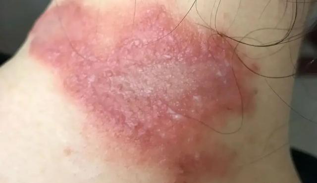 珠江|夏天野钓要小心这3种动物，比蚊子狠太多