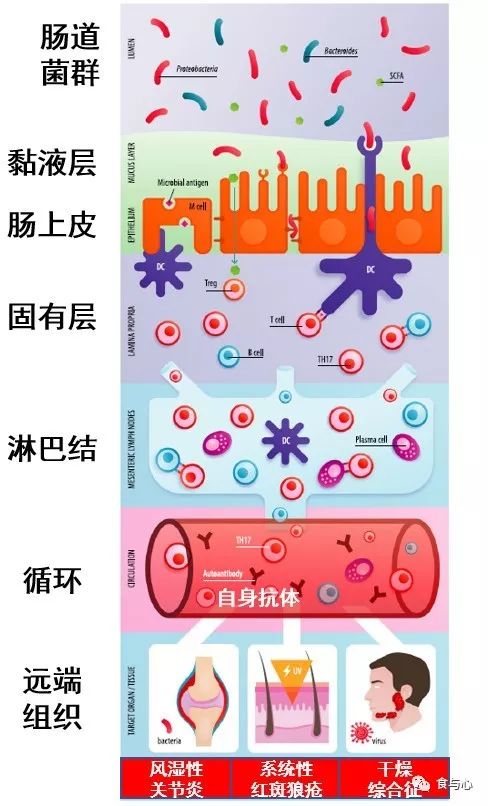 牛皮癣|肠漏，你必须知道的热知识12：牛皮癣、硬皮病和红斑狼疮