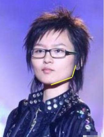 整容|周笔畅整容成功了！回应：本想整成杨幂，结果整成了刘诗诗、杨紫