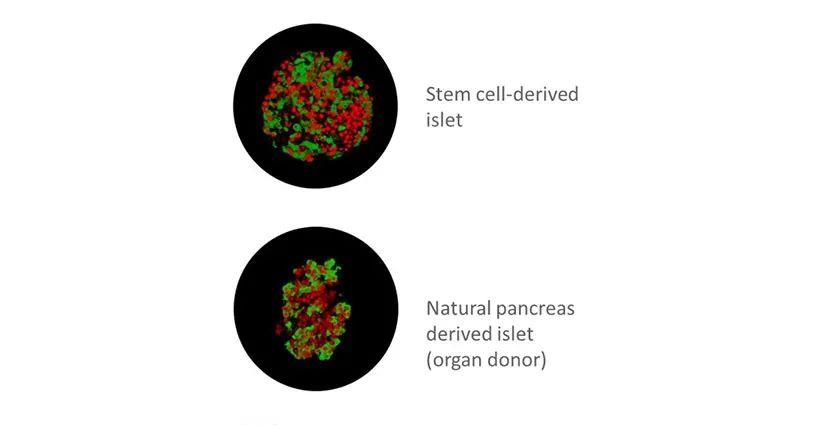 干细胞在糖尿病领域展望:MSCs到iPSCs,再生医学的自我颠覆之路