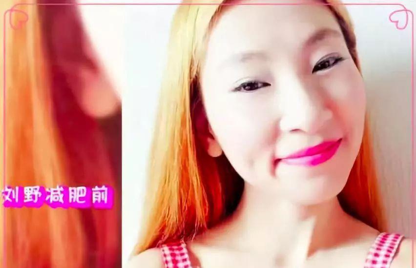 短发|“骷髅妹”：因爱“自虐”减肥，从120斤减到57斤，瘦成了皮包骨