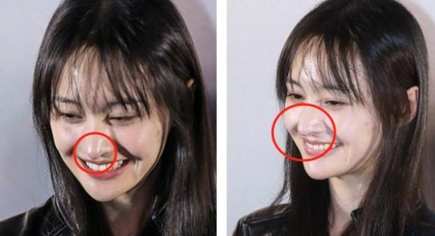 郑爽|郑爽曾隆鼻子又装回去了?她每次分手必须整容?