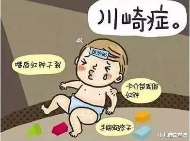小儿推拿李波|小儿推拿李波：儿童高烧不退，警惕川崎病！有哪些症状？如何应对