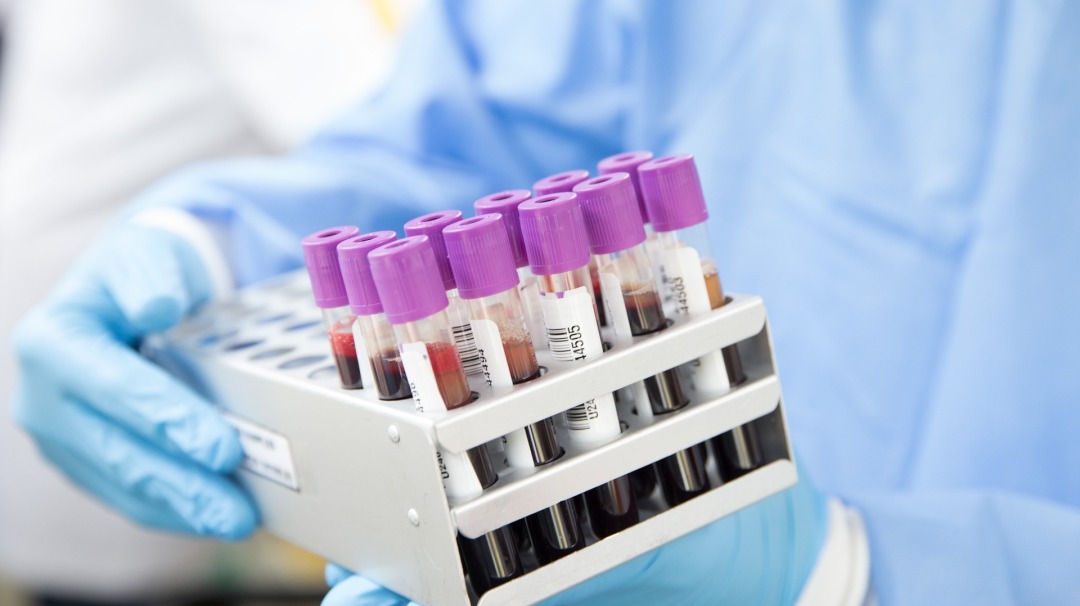 神经元 带你深入了解——阿尔茨海默病