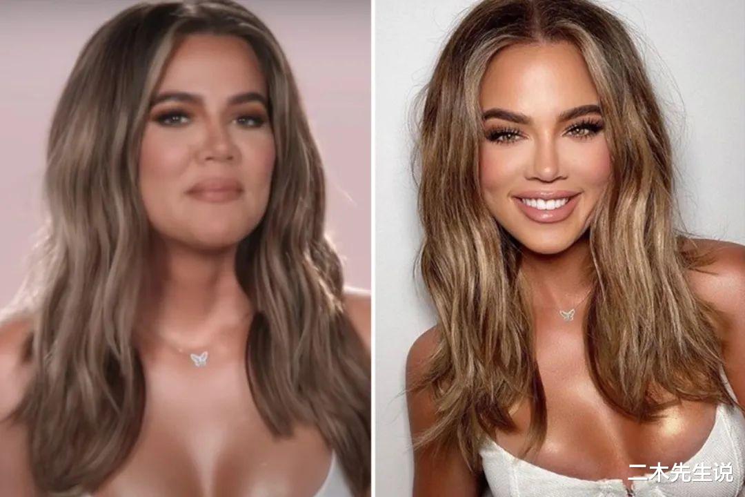 金·卡戴珊|科勒卡戴珊一张未修图被曝光，整个卡戴珊家族整个炸了锅