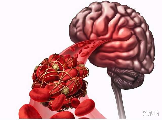 脑梗|脑梗患者，家庭康复有妙招，坚持5个“不”，敢于正视才能更健康