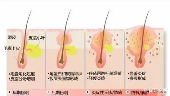 时尚好物官|韩国“素颜女神”宋智孝老了？素颜出街满脸透亮，网友：打脸太快