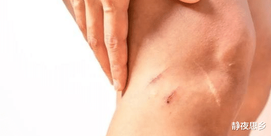 科学家 人体正在长出一块新骨头！科学家称不是好兆头，会让我们很痛苦