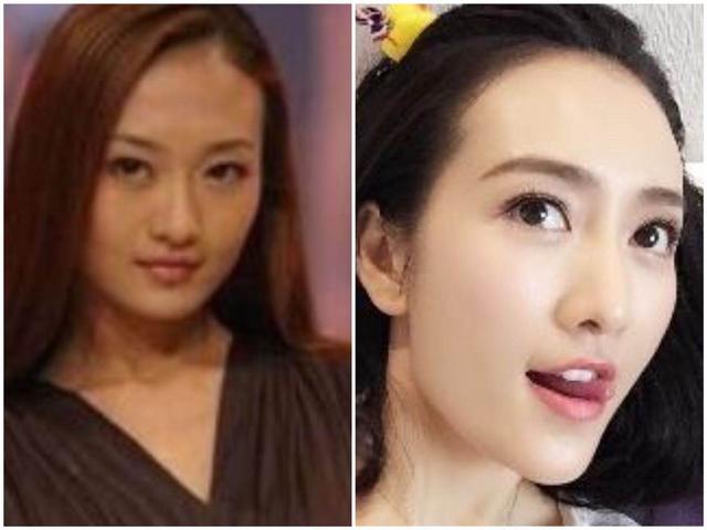 好物官|泰国嫩模为美白“无底线”，连打美白针，现在的样子她老公都害怕