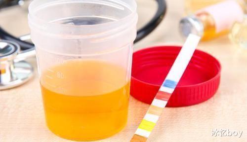 尿酸|痛风“源头”找到，不是高嘌呤食物，常吃1物，尿酸匀速降下