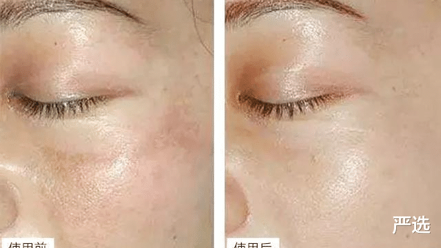 百雀羚 继“百雀羚”后，中国又一“平民”面霜走红！高质低价皮肤白白