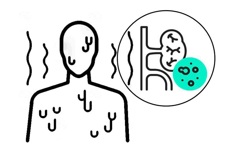 肾病|肾病不是小事，身体4个异常其实是暗示，早抓住机会或能救肾一命