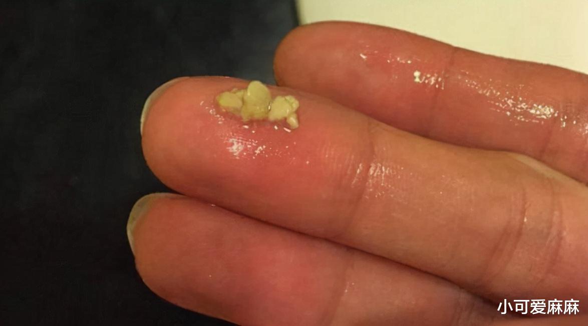 小可爱麻麻|6岁男孩因“口臭”被同学嫌弃，送医检查后，护士都没忍住呕吐