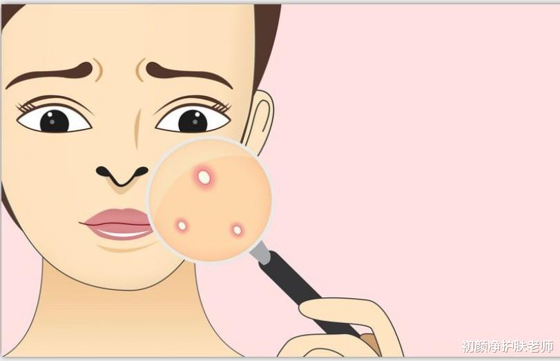 初颜净护肤老师 熬夜对皮肤的伤害有多大!你知道吗?