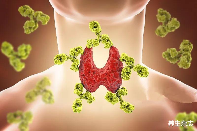 尿酸|转告父母：3种调料，是甲状腺结节“加速器”，做菜时尽量少放