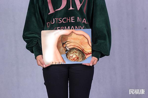 |女人在什么时候绝经?月经要离开时,会有哪些表现?