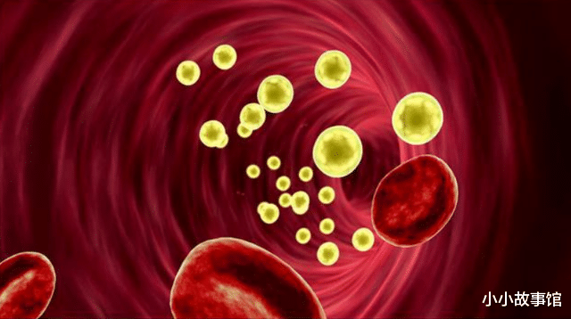 国家卫健委|血脂高的人要远离豆腐?提醒:不想血脂升高,3种素食尽量少吃