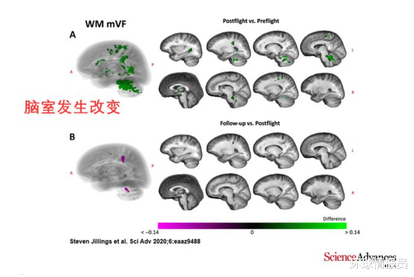 太空即地狱? 14名宇航员DNA水平飙升数百倍,科学家:情况不容乐观