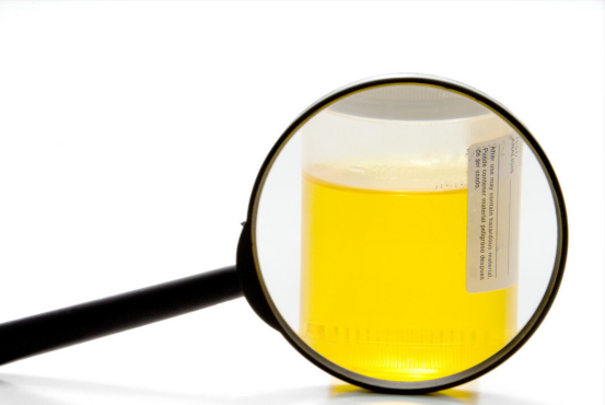 健康追酱|上厕所时，若有4种异常，很有可能是肝炎恶化，需及时调理