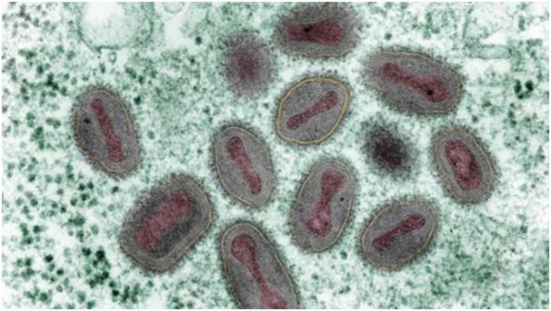 天花|生物恐袭要来了？美制药巨头惊现“天花病毒”，比尔?盖茨神预测