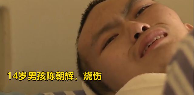 四叶草海之恋|半边身体被烧焦!湖南女子遗弃小儿子逼大儿子救治:我走投无路了