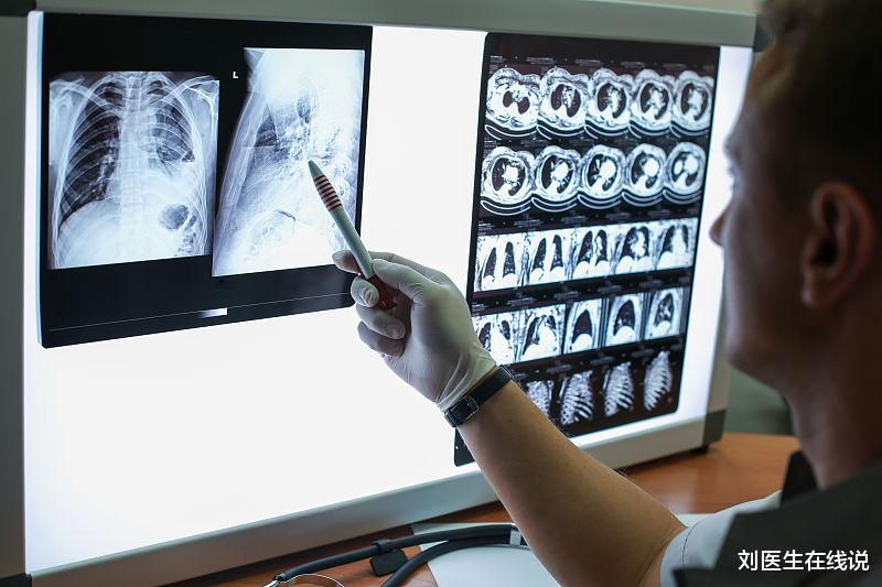 青光眼|这种病是“慢性子”!预防做好六件事