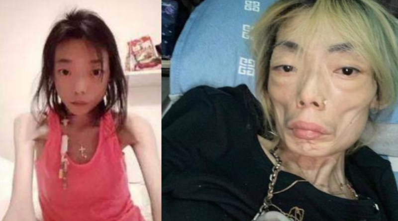 |伍智恒：22岁成百亿阔太，丈夫一句“你胖了”，从此瘦成外星人