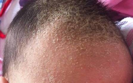 夏玲育儿|新生儿囟门护理不当送急诊，囟门护理有门道，妈妈们要这样做