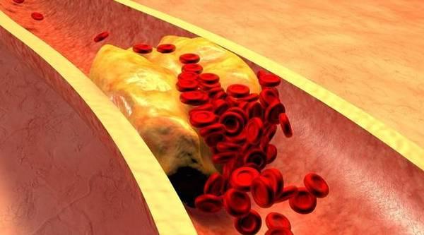 医生|经常走路对血管好？医生建议：想保护血管，这几件事可多做