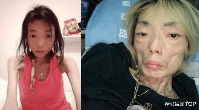 |伍智恒：22岁成百亿阔太，丈夫一句“你胖了”，从此瘦成外星人