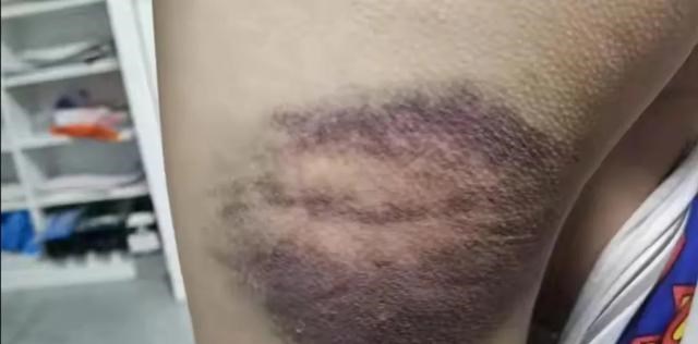 黄金 石家庄夏令营堪称集中营！11岁女孩被打吐血，3名孩子写纸条求救