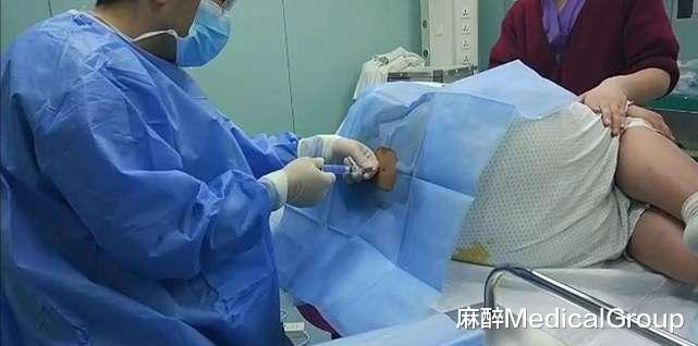 麻醉MedicalGroup 手术台上，她感觉腿一直“翘”在那里