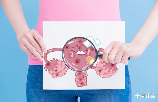 妇科炎症|28岁女子被妇科炎症困扰2年,妇科医生:私处护理很重要