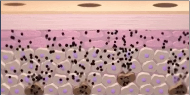 萌萌一笔|面部长斑,该怎么定制皮肤管理?