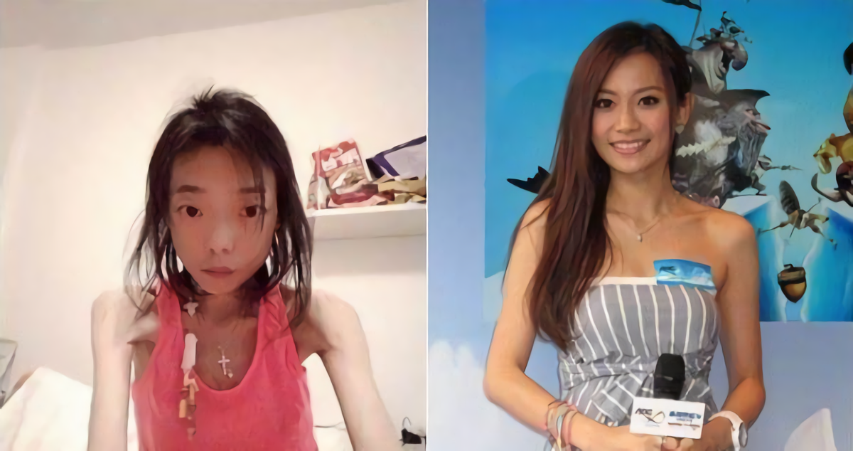 超模|22岁甜美名模嫁入豪门,8年被折磨成“骷髅人”,惨遭扫地出门