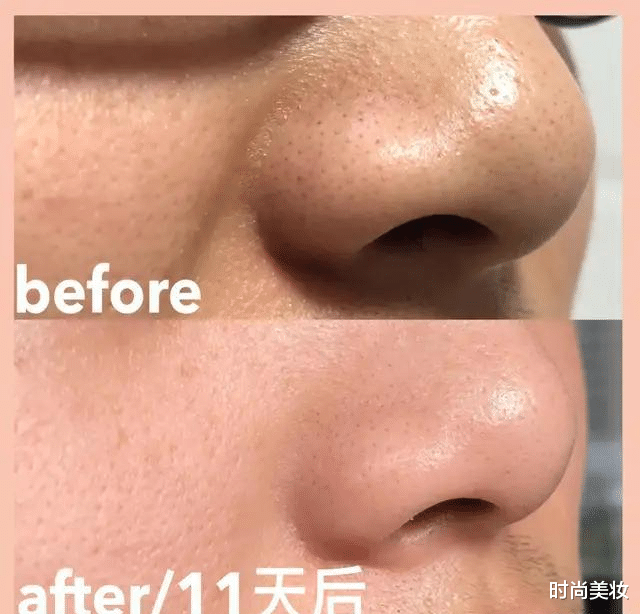 时尚美妆|学关晓彤的洗脸方法，肌肤光滑又细腻，难怪她素颜皮肤也那么好！